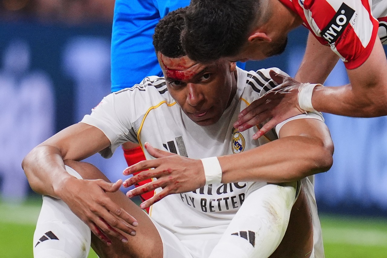 Kylian Mbappé